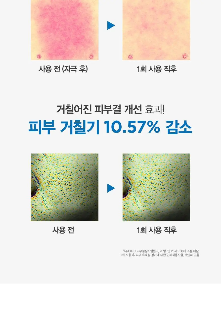 [SOS 진정크림] 유리아쥬 푸루리시드 칼라민 젤크림 100ml 기획 (+스탠드 증정) 상세페이지 9